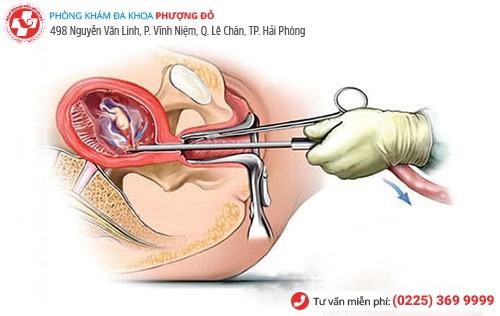Cách phá thai an toàn khi cho con bú
