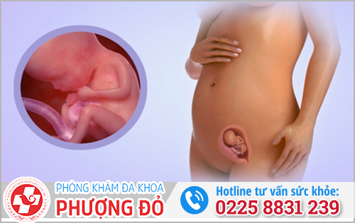 Phá thai 15 tuần