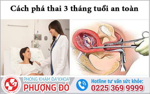 Phá thai 3 tháng rưỡi