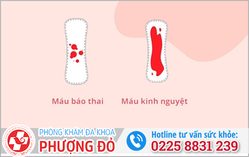 Dấu hiệu trễ kinh do mang thai